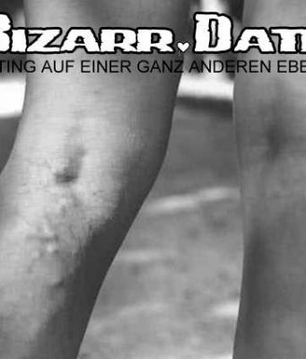 Sexy Krampfadern an meinen langen Beinen Ich habe sexy Krampfadern.